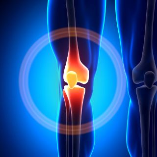 Supporto continuo alle articolazioni